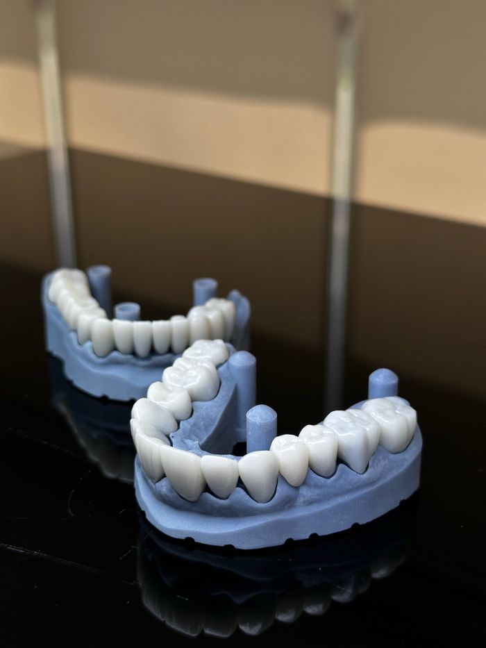 about-01 Two realistic dental impressions displayed on a shiny black surface with soft lighting.