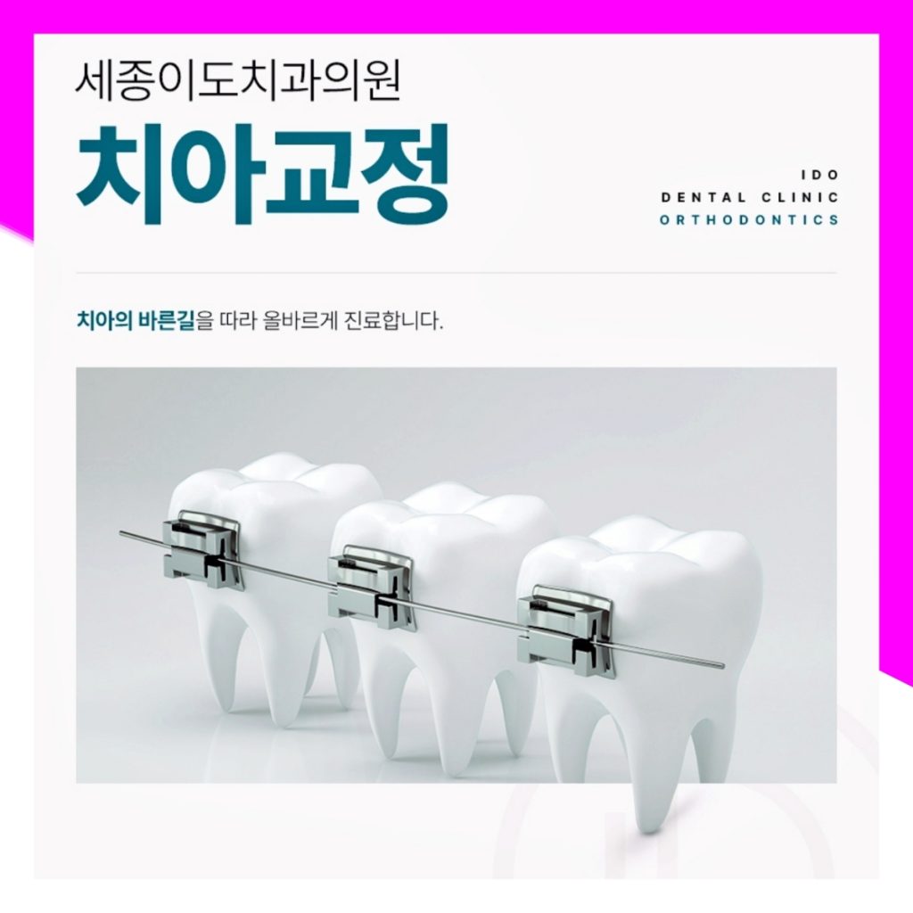 세종교정치과 치아교정을 고민하고 있다면 알아두면 좋은 정보