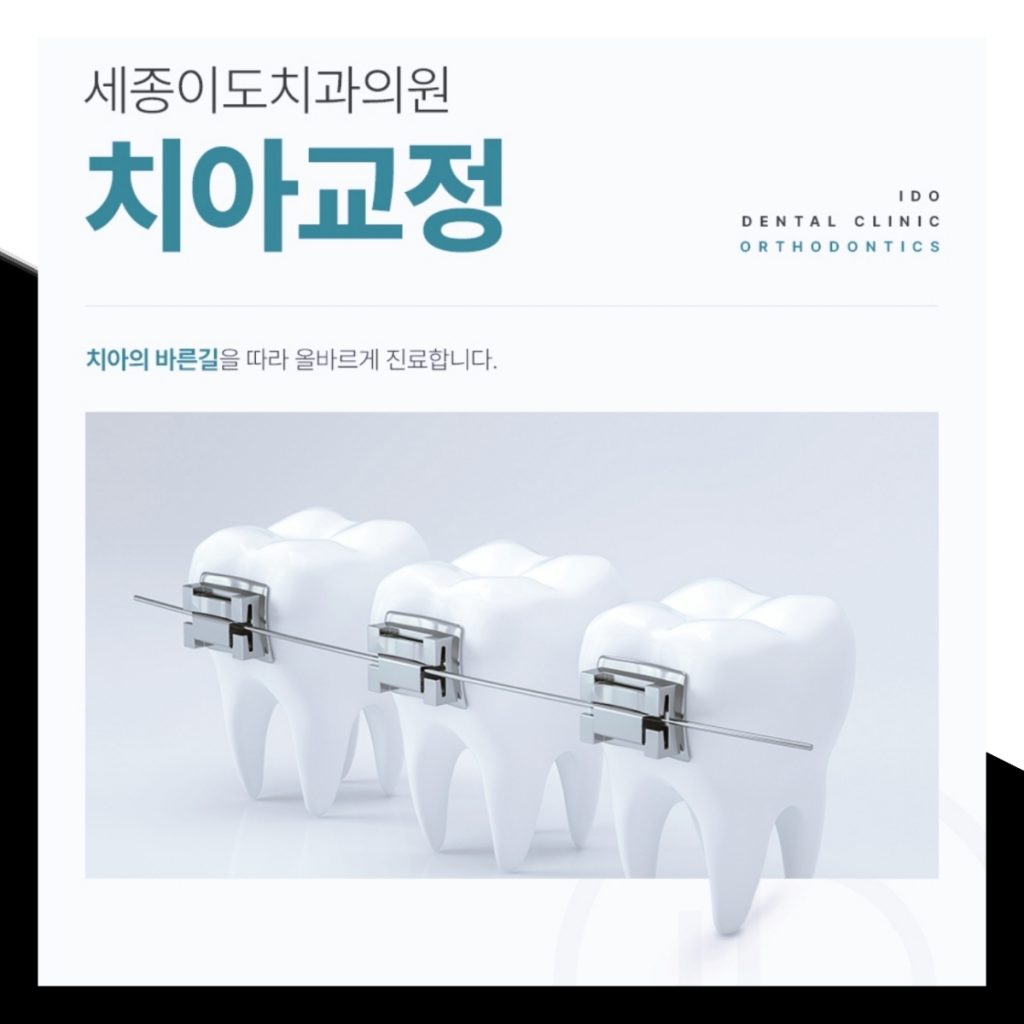 세종시교정치과 치아교정 시작 전 알아두면 좋은 정보
