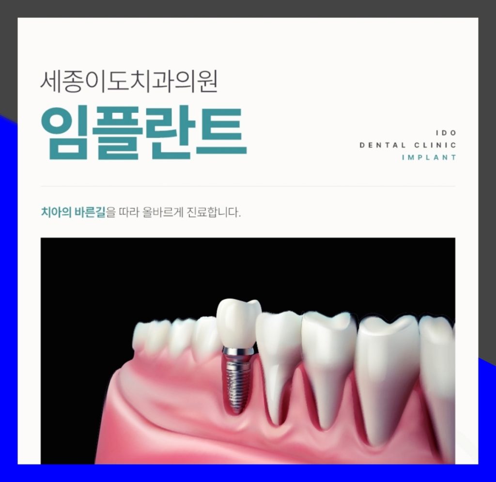 세종시임플란트 오래 사용하기 위해 확인해야 할 점
