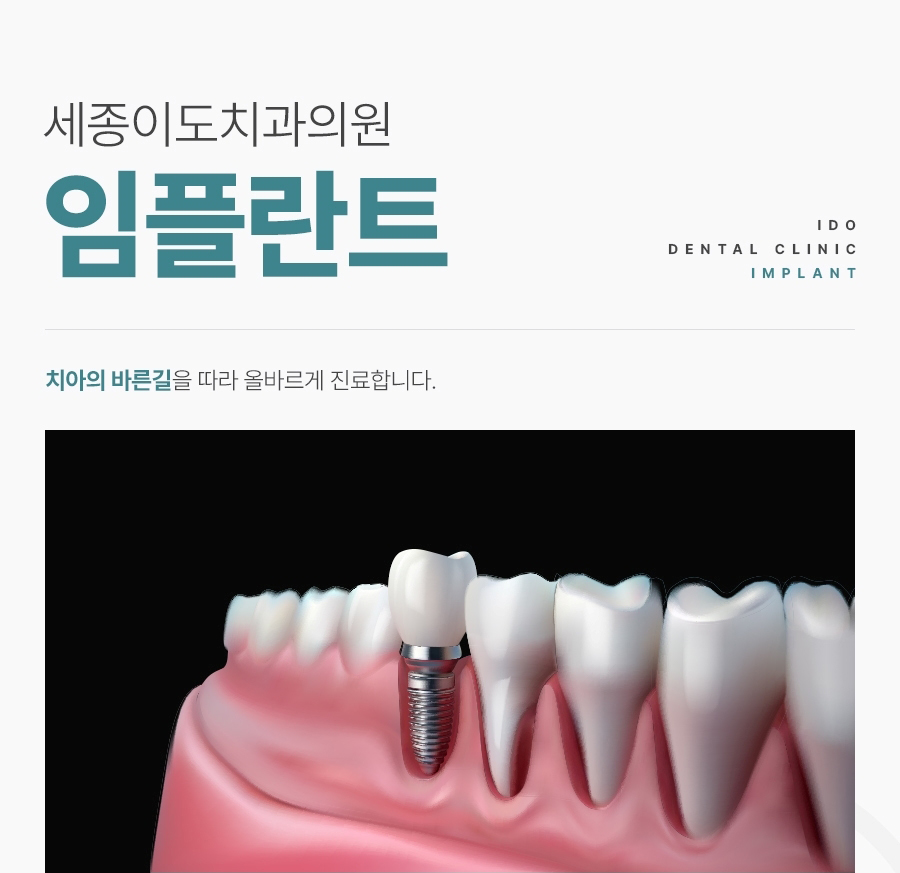 세종이도치과 임플란트 이미지 (1)