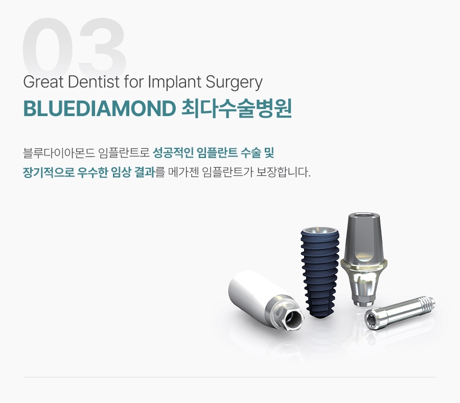 세종이도치과 임플란트 이미지 (4)