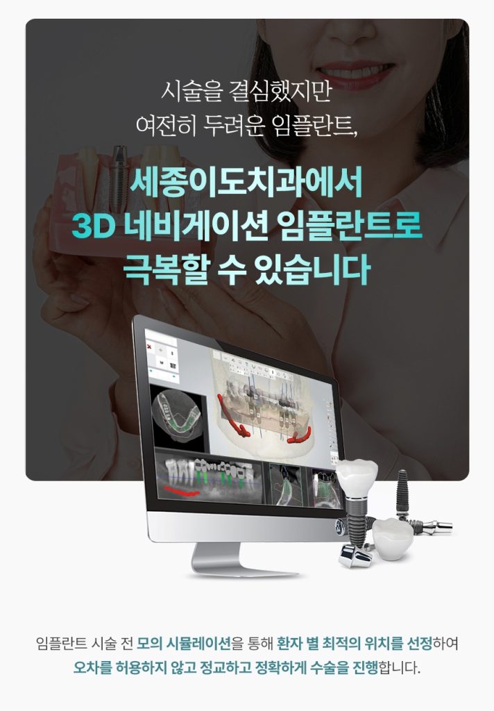 세종이도치과 임플란트 이미지 (6)