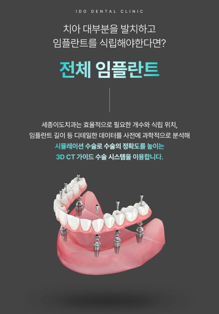세종이도치과 임플란트 이미지 (9)