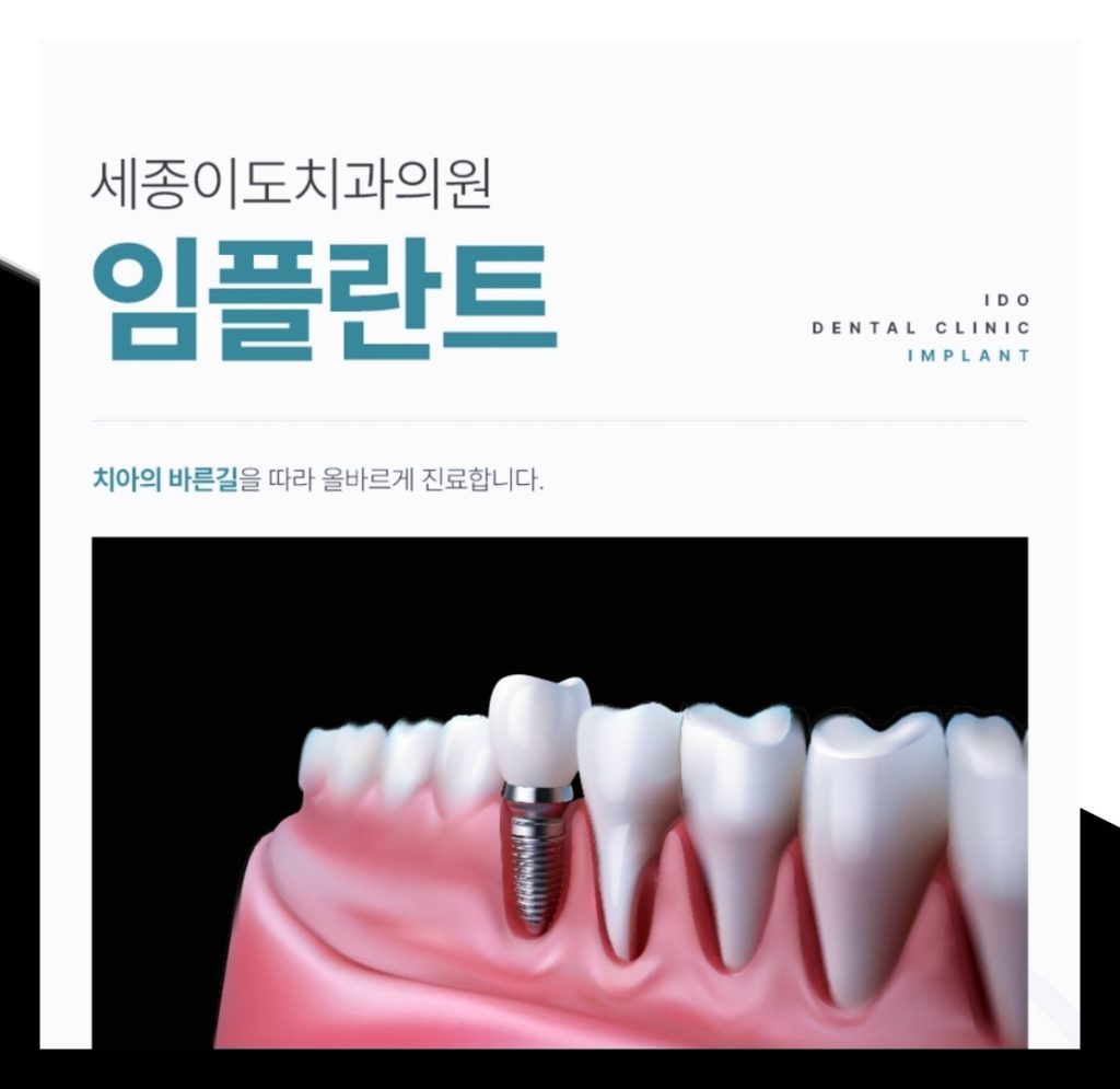세종치과 임플란트 고민 중이라면 알아두면 좋은 정보