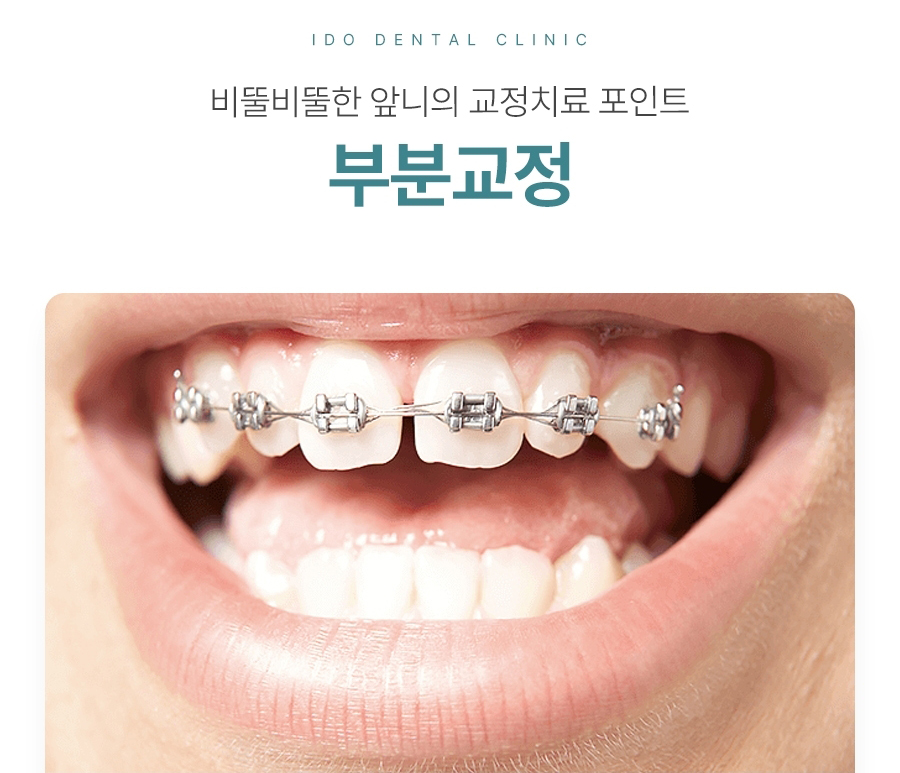 치아교정 페이지 이미지 (10)