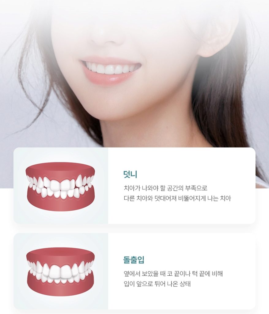 치아교정 페이지 이미지 (14)